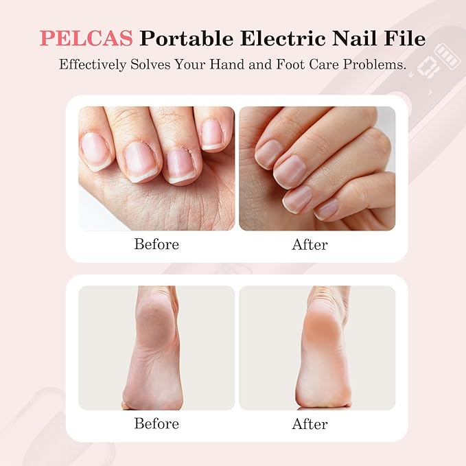 PELCAS Electric Nail File, 10 Speeds Cordless Nail Drill Kit with LED Light, Professional Nail Grinder with LCD Screen Portable e File for Human, Pet, Thick Toenails, Natural & Acrylic Nails Pink
